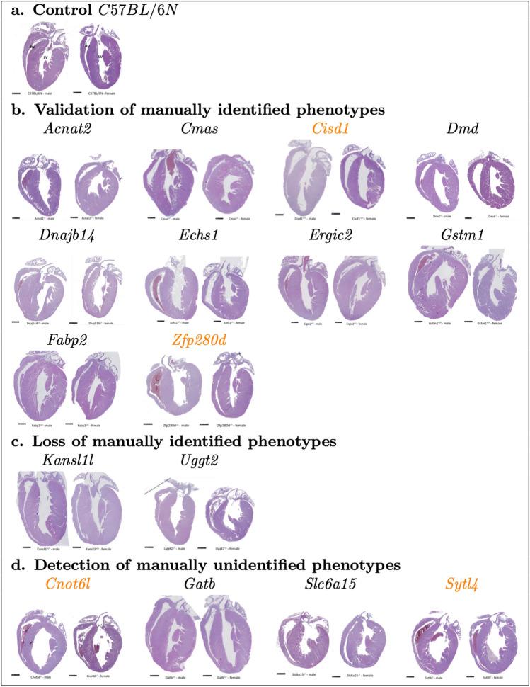 https://cdn.ncbi.nlm.nih.gov/pmc/blobs/2d5e/10290584/ad9866fba39f/335_2023_9996_Fig4_HTML.jpg