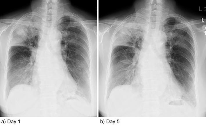 https://cdn.ncbi.nlm.nih.gov/pmc/blobs/2d5e/5491814/8b5b554471bb/1349-7235-56-1185-g001.jpg