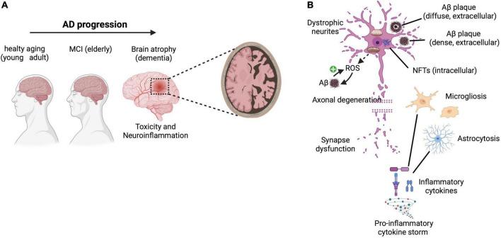 https://cdn.ncbi.nlm.nih.gov/pmc/blobs/2d5f/9387393/7b749380b85e/fnins-16-939855-g001.jpg