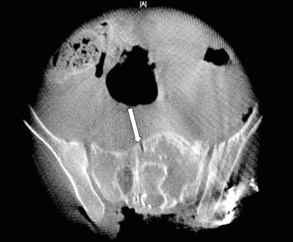 https://cdn.ncbi.nlm.nih.gov/pmc/blobs/2d68/4671841/ad4ec255d98c/cureus-0007-000000000373-i04.jpg