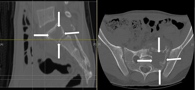 https://cdn.ncbi.nlm.nih.gov/pmc/blobs/2d68/4671841/f32cb86de6ff/cureus-0007-000000000373-i02.jpg