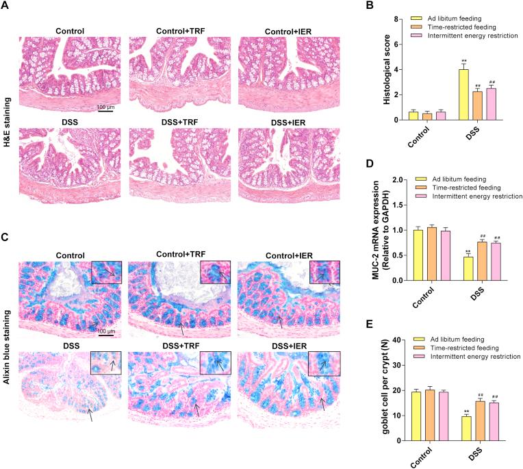 https://cdn.ncbi.nlm.nih.gov/pmc/blobs/2d6c/7162980/0e3556095067/gr2.jpg