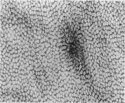 https://cdn.ncbi.nlm.nih.gov/pmc/blobs/2d71/2002361/09a8e950ae39/ijexpath00022-0112-a.jpg