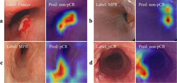 https://cdn.ncbi.nlm.nih.gov/pmc/blobs/2d73/12089136/e6acd79bfa4e/fonc-15-1590448-g003.jpg