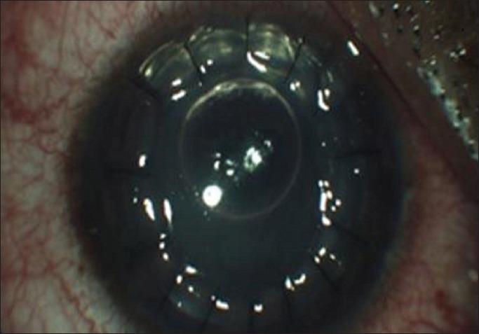 https://cdn.ncbi.nlm.nih.gov/pmc/blobs/2d73/6213700/39aa08a226db/IJO-66-1574-g001.jpg