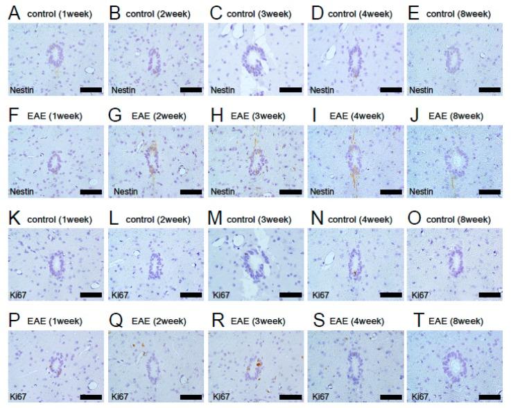 https://cdn.ncbi.nlm.nih.gov/pmc/blobs/2d76/6769975/c455dbf1e2d4/cells-08-01025-g005.jpg