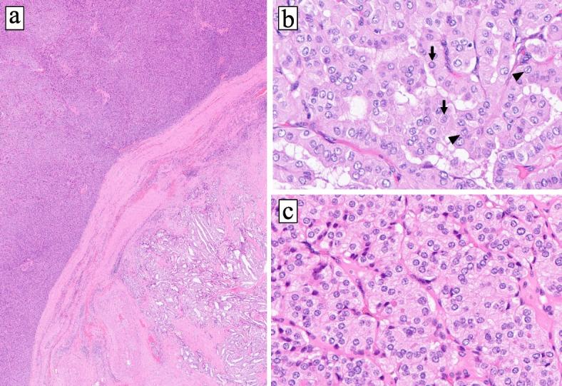 https://cdn.ncbi.nlm.nih.gov/pmc/blobs/2d7c/10405457/4a7f9ca01169/13044_2023_167_Fig3_HTML.jpg