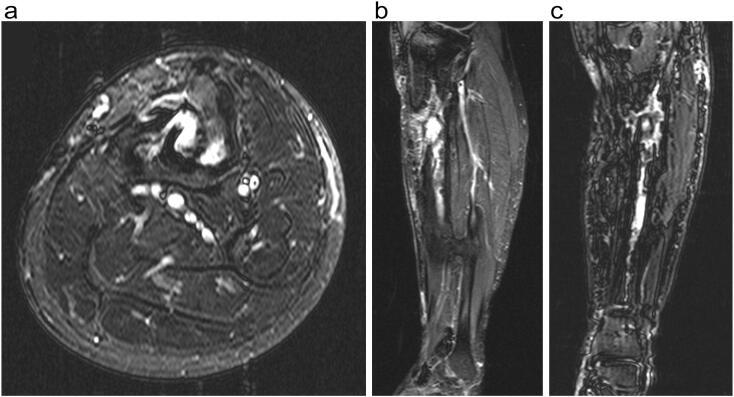 https://cdn.ncbi.nlm.nih.gov/pmc/blobs/2d80/10440580/efabbca73470/gr4.jpg