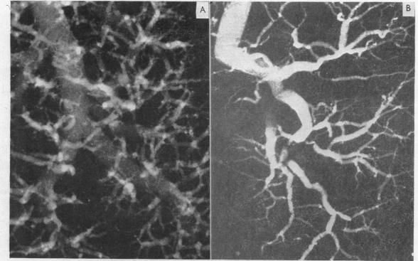 https://cdn.ncbi.nlm.nih.gov/pmc/blobs/2d85/503367/001e42841941/brheartj00379-0106-a.jpg