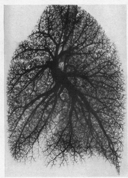 https://cdn.ncbi.nlm.nih.gov/pmc/blobs/2d85/503367/1b5d4dcbeed7/brheartj00379-0105-b.jpg