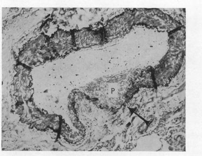 https://cdn.ncbi.nlm.nih.gov/pmc/blobs/2d85/503367/ae7e3db58841/brheartj00379-0109-a.jpg