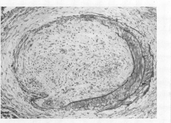 https://cdn.ncbi.nlm.nih.gov/pmc/blobs/2d85/503367/bd69b168f2d4/brheartj00379-0110-b.jpg