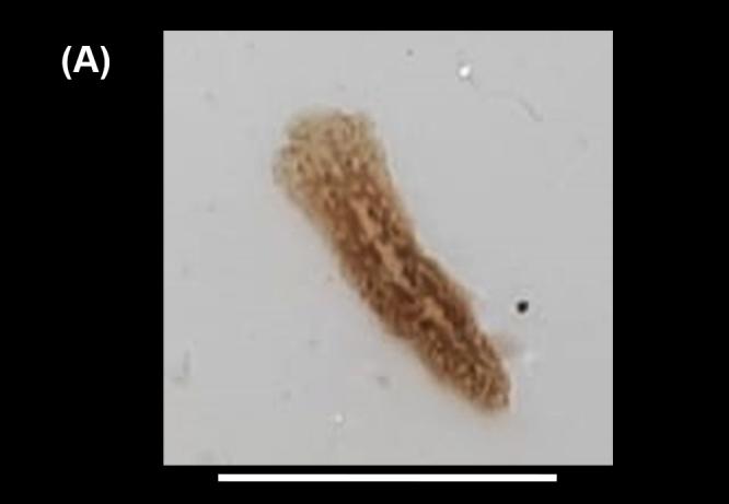 https://cdn.ncbi.nlm.nih.gov/pmc/blobs/2d87/8390885/da6426e82f3a/bdj-09-e62736-g002_a.jpg