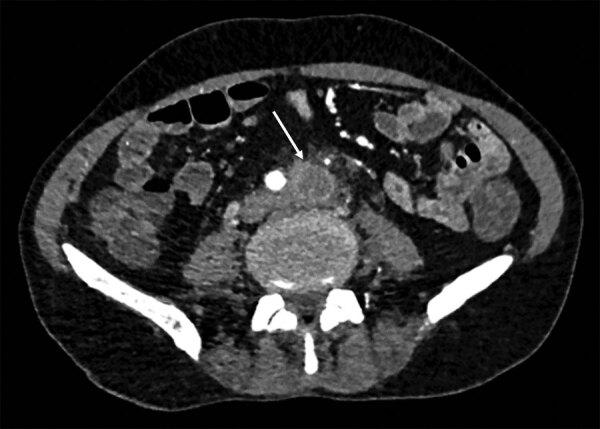 https://cdn.ncbi.nlm.nih.gov/pmc/blobs/2d8d/11138966/0dc3229de112/23-1409-F1.jpg
