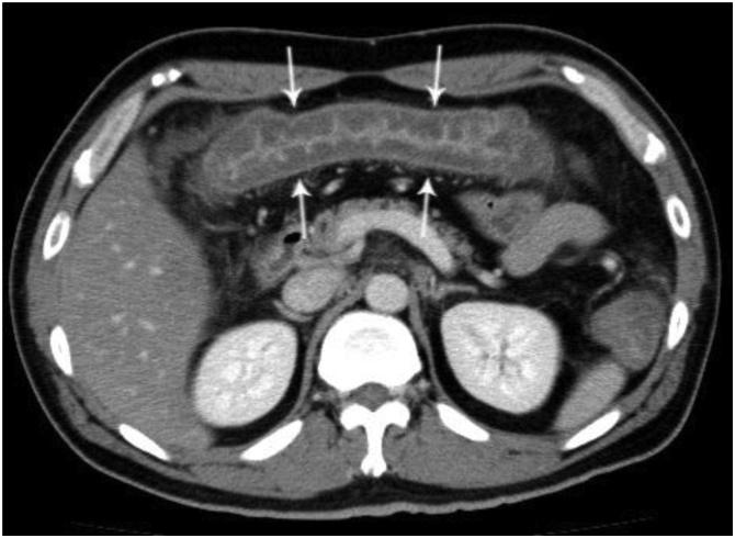 https://cdn.ncbi.nlm.nih.gov/pmc/blobs/2d93/6515127/270204254388/gr1.jpg