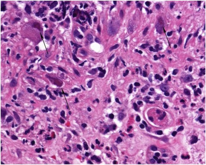 https://cdn.ncbi.nlm.nih.gov/pmc/blobs/2d93/6515127/3b4f5b1da253/gr3.jpg