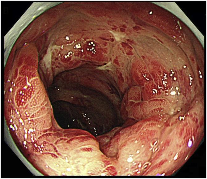 https://cdn.ncbi.nlm.nih.gov/pmc/blobs/2d93/6515127/92fe014217b1/gr2.jpg