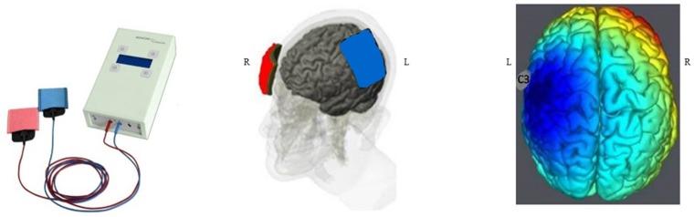 https://cdn.ncbi.nlm.nih.gov/pmc/blobs/2d9f/6190876/55958e0ef675/fneur-09-00816-g0002.jpg