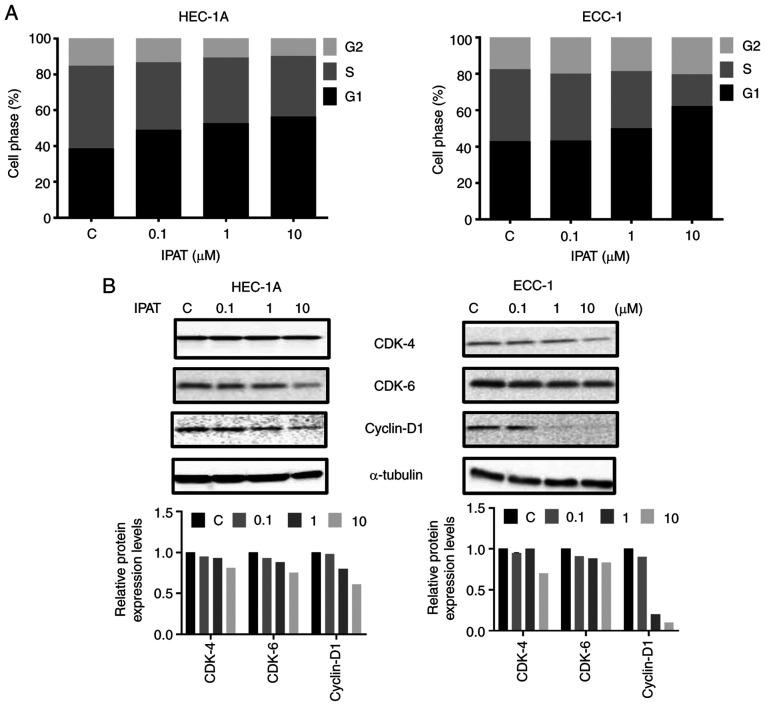 https://cdn.ncbi.nlm.nih.gov/pmc/blobs/2da1/10552741/4993d5ba72dd/IJO-63-3-05551-g01.jpg