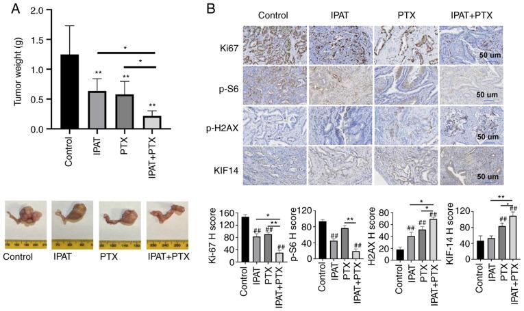 https://cdn.ncbi.nlm.nih.gov/pmc/blobs/2da1/10552741/b6c54b0dca5a/IJO-63-3-05551-g05.jpg