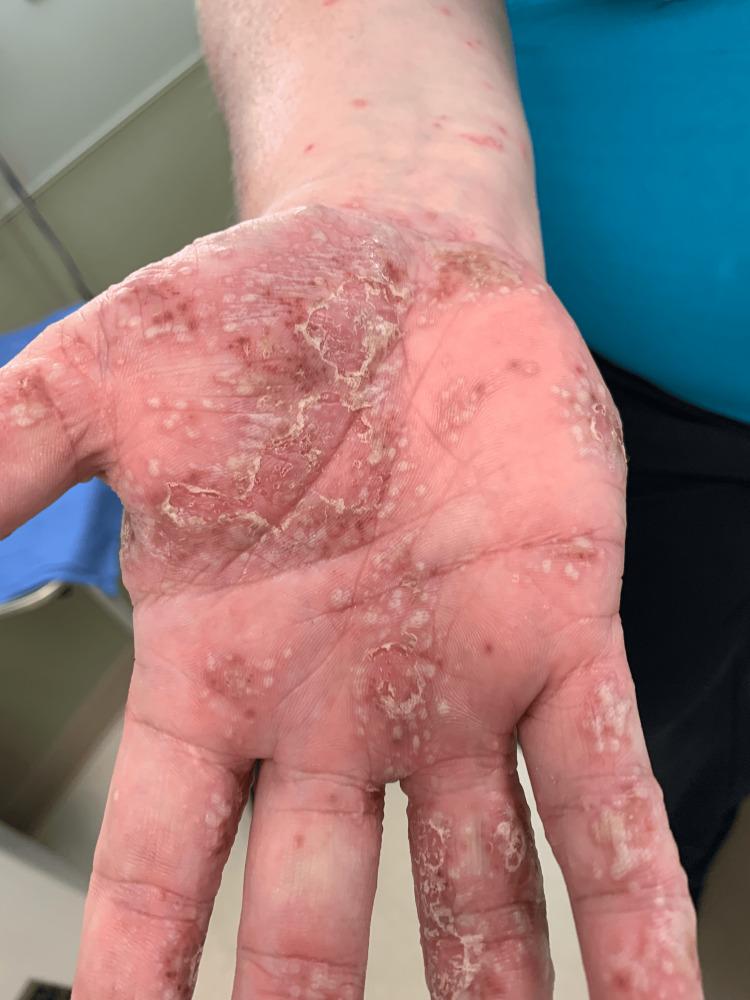 https://cdn.ncbi.nlm.nih.gov/pmc/blobs/2da8/11710852/1c2675da60d8/cureus-0016-00000075402-i02.jpg