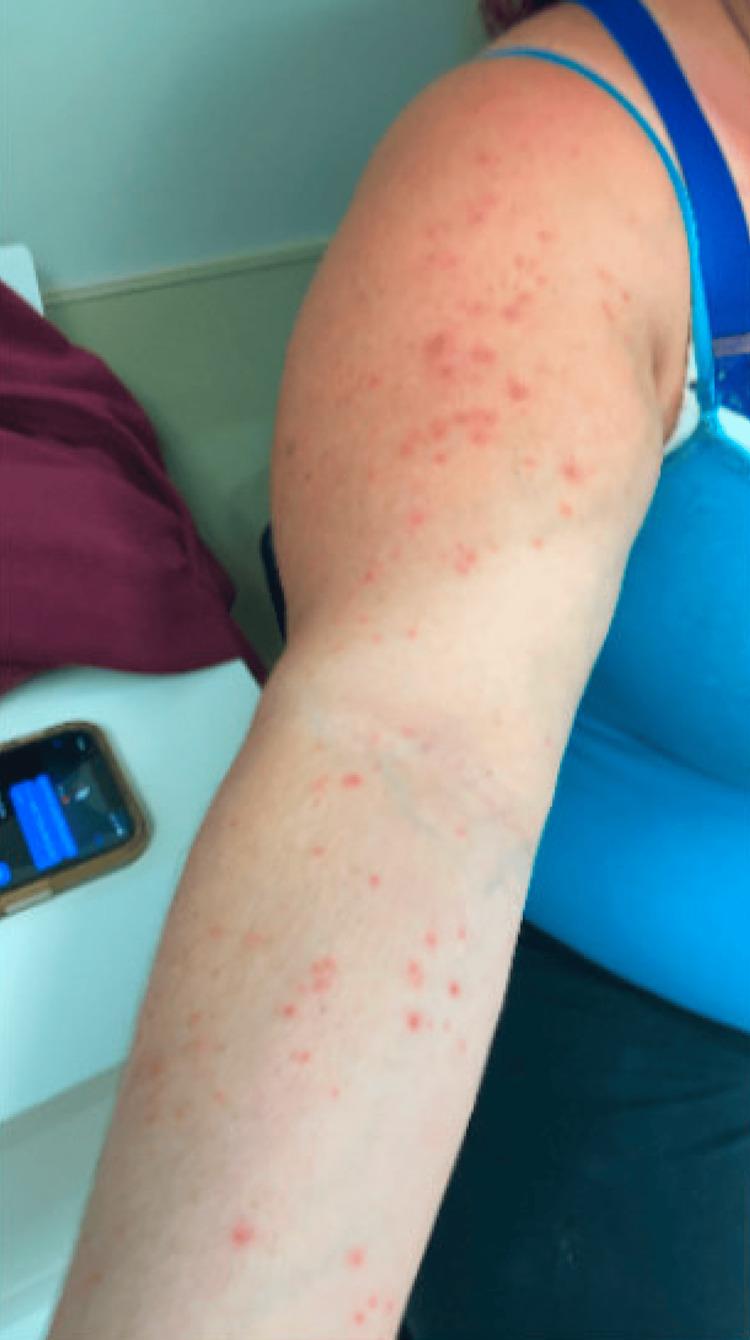 https://cdn.ncbi.nlm.nih.gov/pmc/blobs/2da8/11710852/84a21593f113/cureus-0016-00000075402-i04.jpg