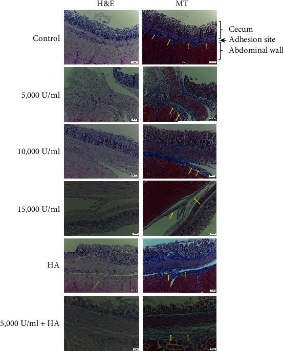 https://cdn.ncbi.nlm.nih.gov/pmc/blobs/2daa/9851794/f90ecbcb5a0c/BMRI2023-4050730.001.jpg