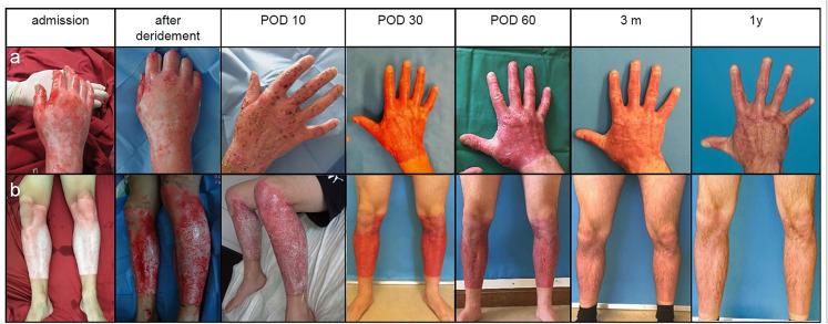 https://cdn.ncbi.nlm.nih.gov/pmc/blobs/2dab/8743980/8ad9ae4f013a/10.1177_20595131211052394-fig4.jpg