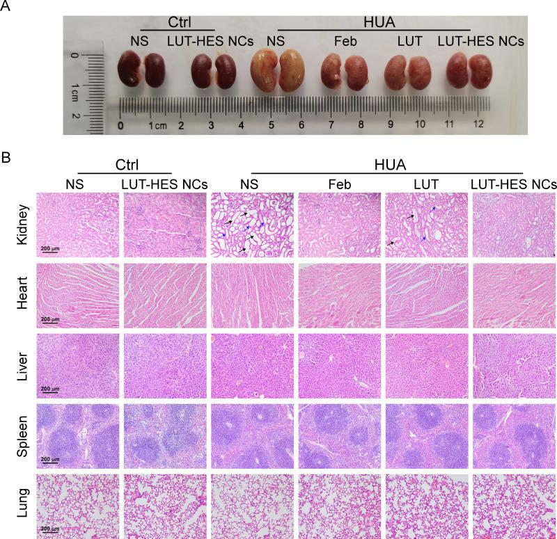 https://cdn.ncbi.nlm.nih.gov/pmc/blobs/2db2/11162967/70c41a0d1a1c/IJN-19-5139-g0011.jpg