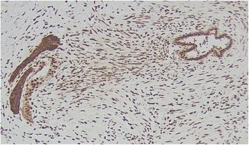 https://cdn.ncbi.nlm.nih.gov/pmc/blobs/2db2/5738062/4b2b28822943/12957_2017_1294_Fig5_HTML.jpg