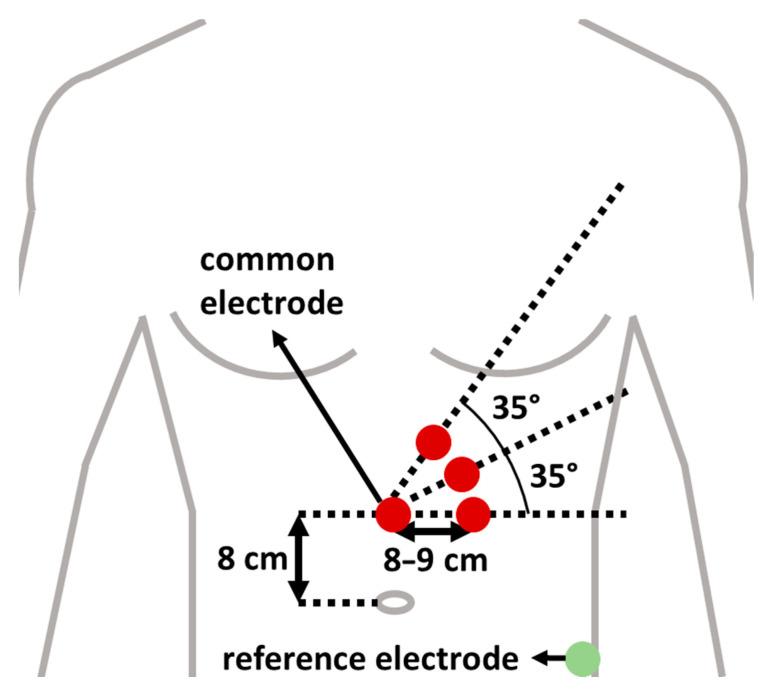https://cdn.ncbi.nlm.nih.gov/pmc/blobs/2db3/7830998/3566e2875fb2/sensors-21-00550-g003.jpg