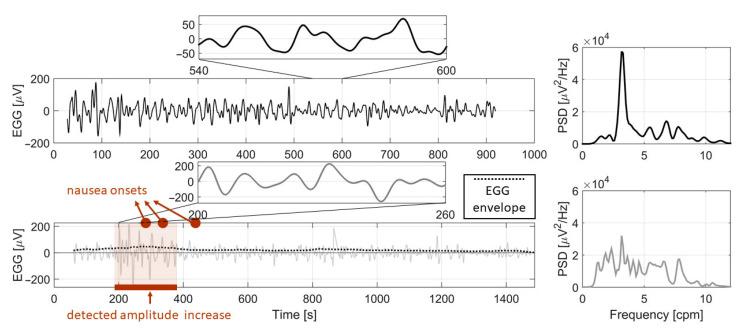 https://cdn.ncbi.nlm.nih.gov/pmc/blobs/2db3/7830998/e292725ecdbb/sensors-21-00550-g005.jpg