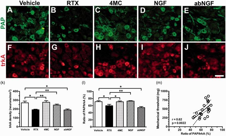https://cdn.ncbi.nlm.nih.gov/pmc/blobs/2dc2/4956004/a5487ec2a7b5/10.1177_1744806916656846-fig4.jpg