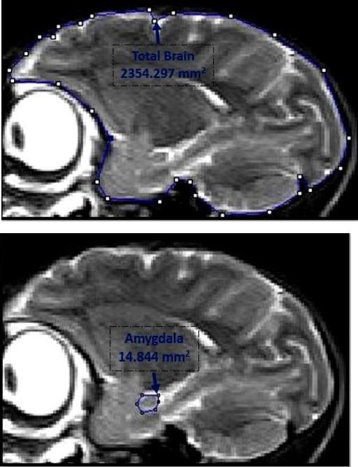 https://cdn.ncbi.nlm.nih.gov/pmc/blobs/2dc3/5651482/f11dcddfb2c7/IJBMS-20-951-g002.jpg
