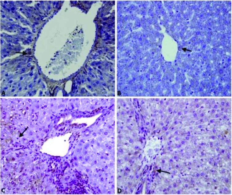 https://cdn.ncbi.nlm.nih.gov/pmc/blobs/2dc6/8283446/45dce057a33d/turkjmedsci-51-1543-fig002.jpg