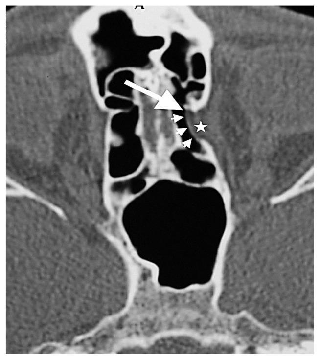 https://cdn.ncbi.nlm.nih.gov/pmc/blobs/2dc7/10381213/31d243376569/turkjmedsci-52-2-370f9.jpg