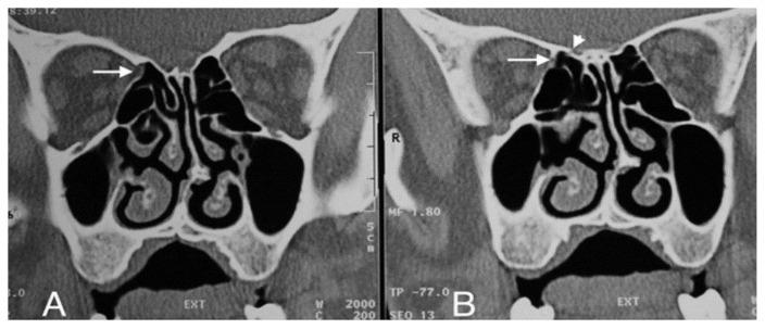 https://cdn.ncbi.nlm.nih.gov/pmc/blobs/2dc7/10381213/7df31fe73baa/turkjmedsci-52-2-370f6.jpg