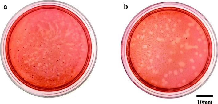 https://cdn.ncbi.nlm.nih.gov/pmc/blobs/2dd0/8286986/f3edc1bc3bd2/44149_2021_13_Fig1_HTML.jpg