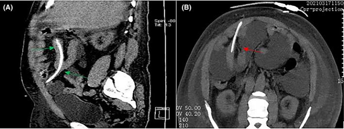 https://cdn.ncbi.nlm.nih.gov/pmc/blobs/2dd4/10769894/46b6caa7a9aa/CCR3-12-e8390-g002.jpg