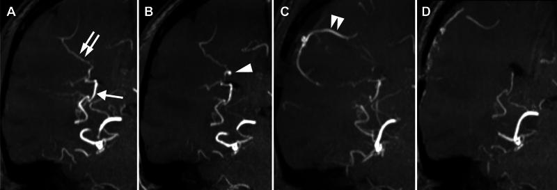 https://cdn.ncbi.nlm.nih.gov/pmc/blobs/2dd8/12260240/936ae3d18ddb/CASE25112_figure_2.jpg