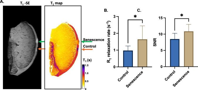 https://cdn.ncbi.nlm.nih.gov/pmc/blobs/2dda/12118744/296475afa7d7/44303_2025_78_Fig3_HTML.jpg