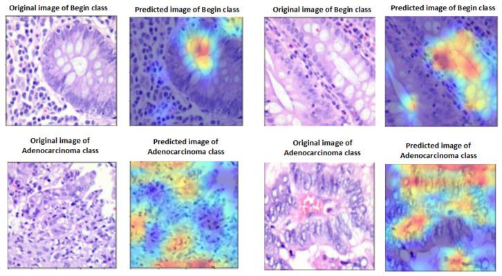 https://cdn.ncbi.nlm.nih.gov/pmc/blobs/2ddb/10529133/e9de5da3ef80/diagnostics-13-02939-g011.jpg
