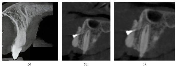 https://cdn.ncbi.nlm.nih.gov/pmc/blobs/2de0/6136495/27a217a400e0/BMRI2018-2059464.004.jpg