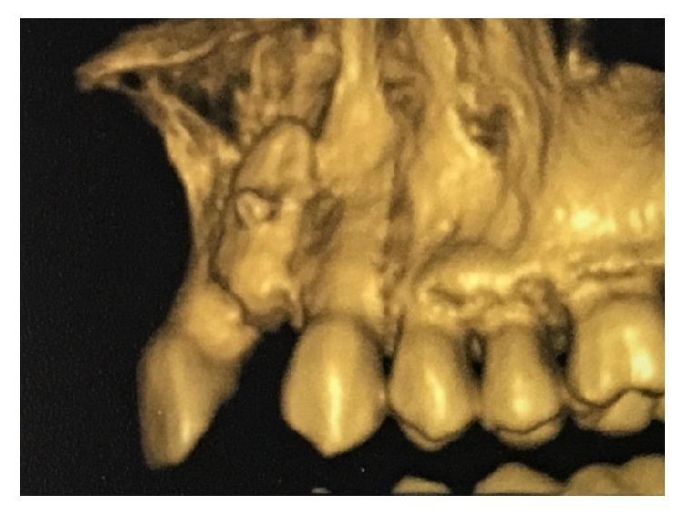 https://cdn.ncbi.nlm.nih.gov/pmc/blobs/2de0/6136495/4a6b9e502f02/BMRI2018-2059464.003.jpg