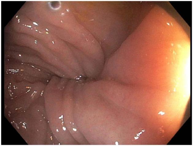 https://cdn.ncbi.nlm.nih.gov/pmc/blobs/2de7/8330459/08dab61f7f8b/10.1177_2333794X211033438-fig3.jpg