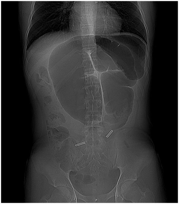 https://cdn.ncbi.nlm.nih.gov/pmc/blobs/2de7/8330459/64639eaadc16/10.1177_2333794X211033438-fig1.jpg