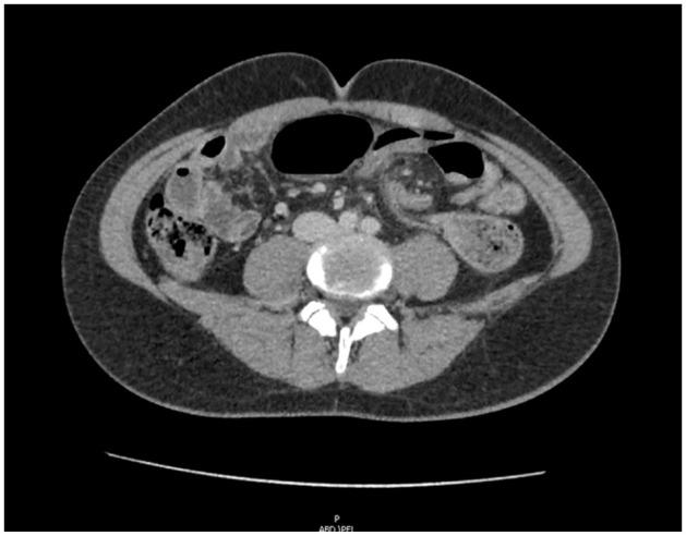 https://cdn.ncbi.nlm.nih.gov/pmc/blobs/2de7/8330459/bcfb3123616d/10.1177_2333794X211033438-fig2.jpg