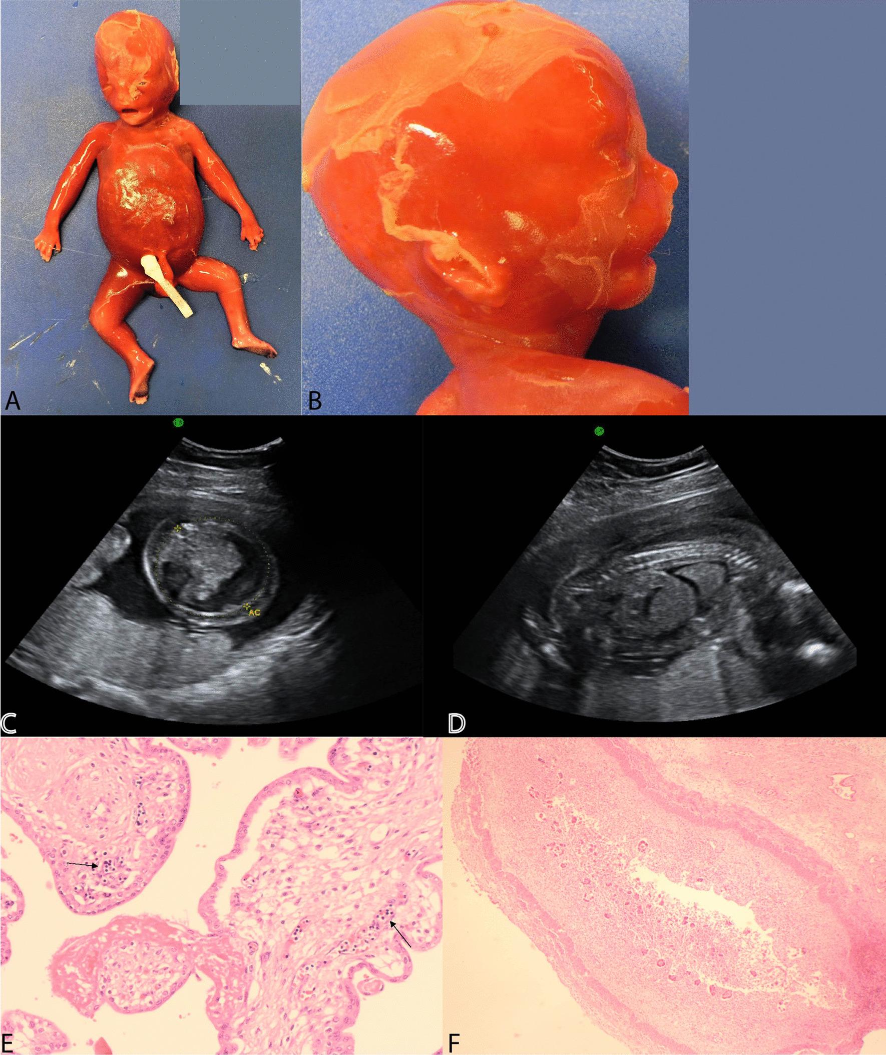 https://cdn.ncbi.nlm.nih.gov/pmc/blobs/2de8/7908803/26adbaaec62c/12920_2021_901_Fig1_HTML.jpg