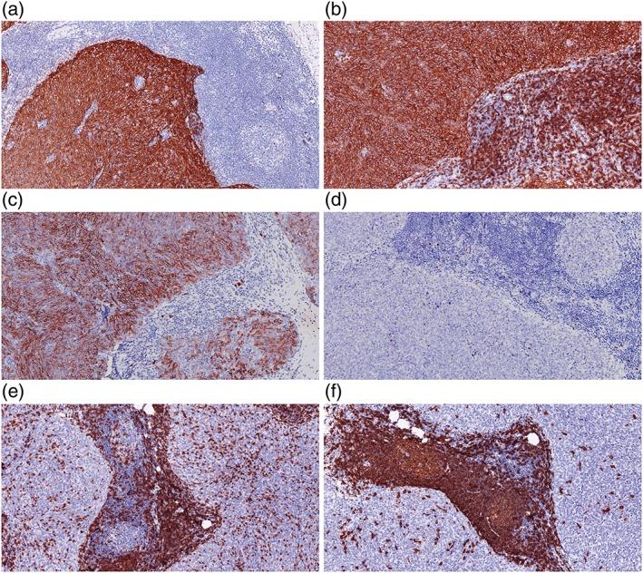 https://cdn.ncbi.nlm.nih.gov/pmc/blobs/2def/5668509/d39cd8814282/TCA-8-734-g004.jpg