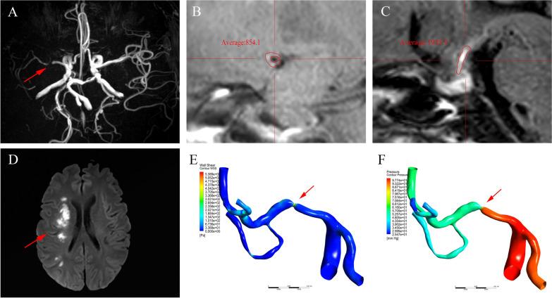 https://cdn.ncbi.nlm.nih.gov/pmc/blobs/2df0/10523698/142d70182f05/40001_2023_1344_Fig1_HTML.jpg